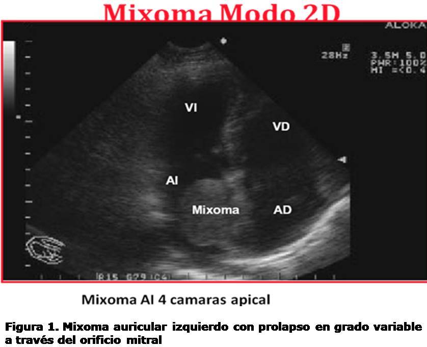 figura 1