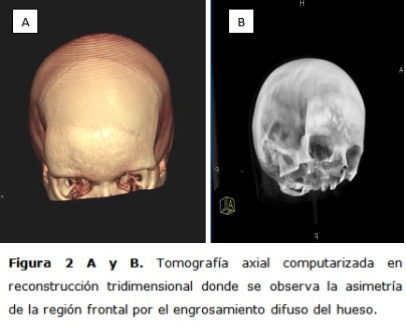 figura2