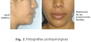 Fig. 7. Fotografías postquirúrgicas 
