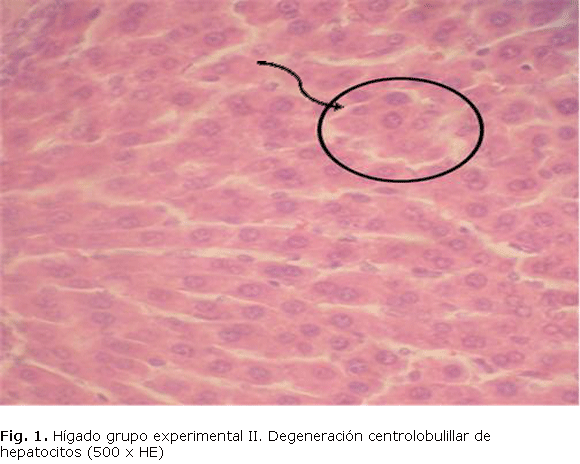 Fig.1. Hígado grupo experimental II. Degeneración centrolobulillar de hepatocitos (500 x HE)