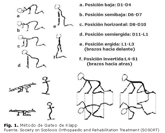 Enfoque actual en la rehabilitación de la escoliosis