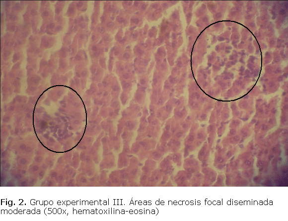 Fig. 2. Grupo experimental III. Áreas de necrosis focal diseminada moderada (500x, hematoxilina-eosina).