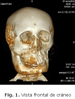 Fig. 1. Vista frontal de cráneo
