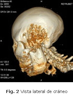 Fig. 2 Vista lateral de cráneo