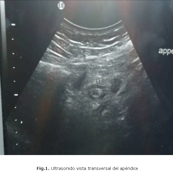 Fig.1 Ultrasonido vista transversal del apéndice