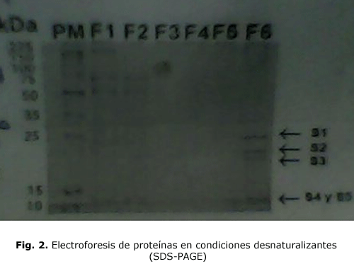 Fig. 2. Electroforesis de proteínas en condiciones desnaturalizantes (SDS-PAGE)
