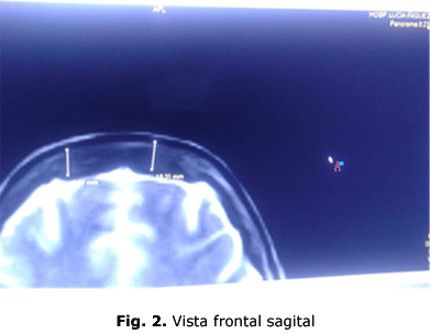 Fig. 2. Vista frontal sagital