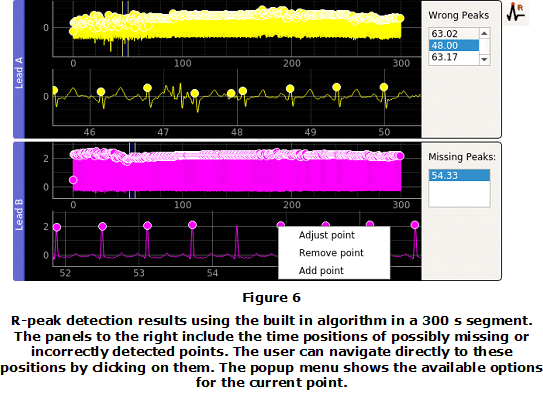 Figure 6. R-peak detection results using the built in algorithm in a 300 s segment. The panels to the right include the time positions of possibly missing or incorrectly detected points. The user can navigate directly to these positions by clicking on them. The popup menu shows the available options for the current point.