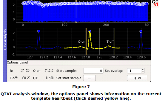 Figure 7. QTVI analysis window, the options panel shows information on the current template heartbeat (thick dashed yellow line).