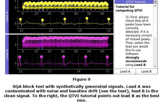 Figure 9. SQA block test with synthetically generated signals. Lead A was contaminated with noise and baseline drift (see the text), lead B is the clean signal. To the right, the QTVI tutorial points out lead B as the best one.
