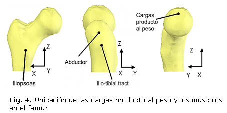 Fig. 4. Ubicación de las cargas producto al peso y los músculos en el fémur