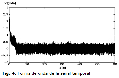 Fig. 4. Forma de onda de la señal temporal