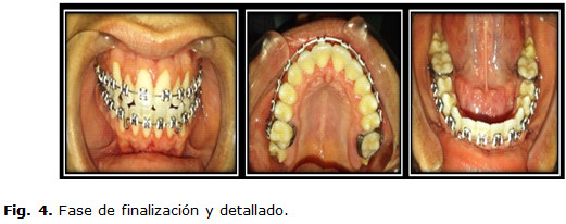 descargar libro ortodoncia moyers