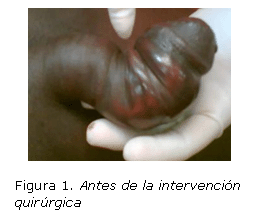  Mujica JC, Zamora C, Serva L, Szemat R, Diéguez V, Luna MT. Traumatismo de pene en el Hospital "Domingo Luciani". Rev Venezolana Cir 2005;58(3):97-101